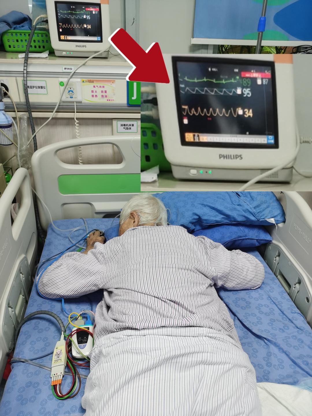 【广东花都发现一例疑似病例，广州花都发现1例新冠肺炎】