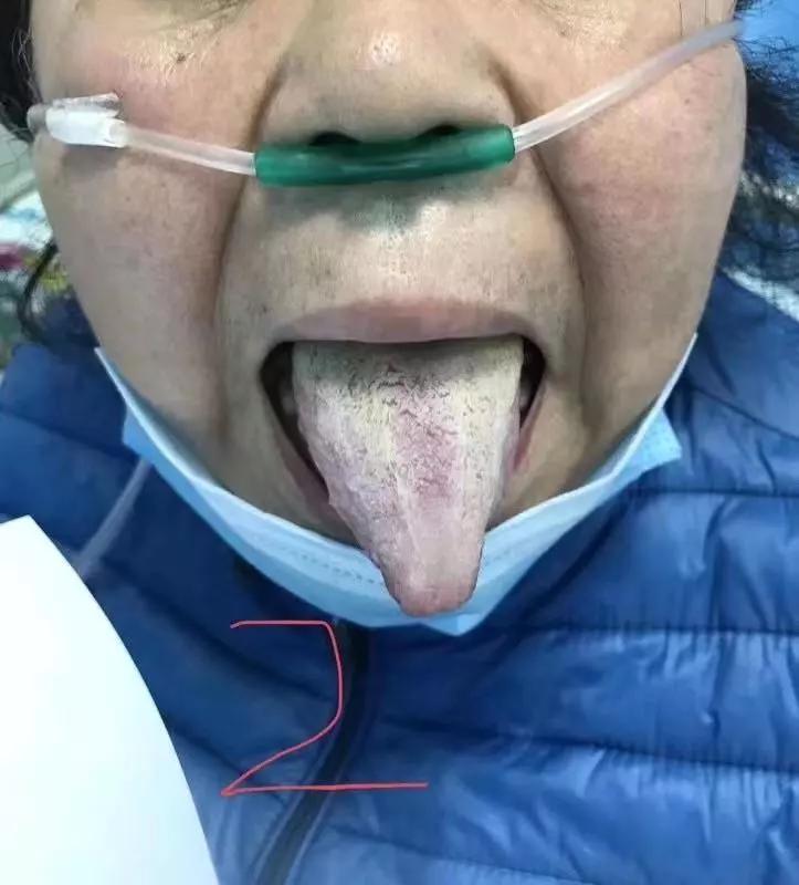 【河南新增1例确诊,河南新增1例确诊新冠肺炎病例】 【河南新增1例确诊,河南新增1例确诊新冠肺炎病例】