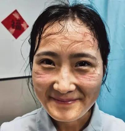 青岛新冠肺炎/青岛新冠肺炎死亡